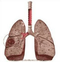 lung(copy)-864